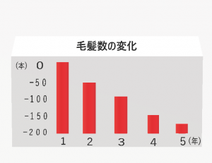 毛髪数の変化